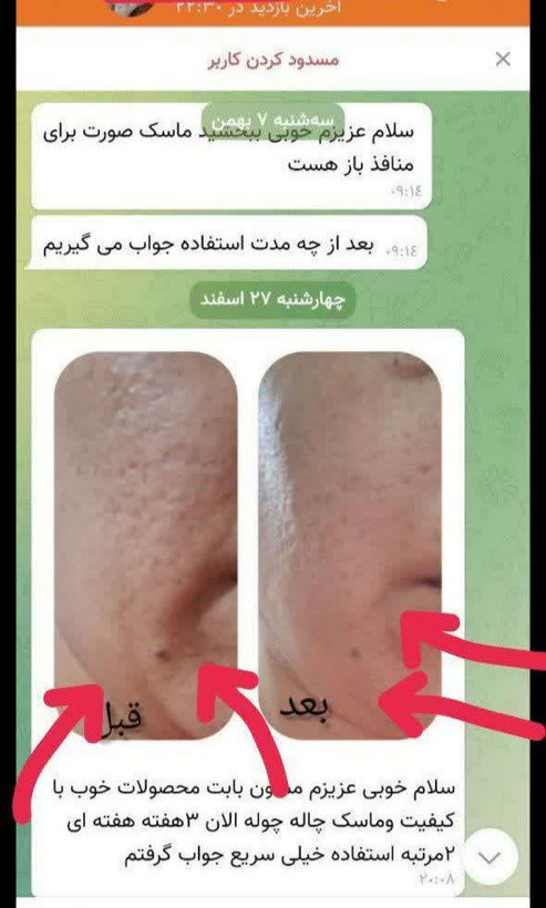پک منافذ باز و پرتقالی (بستن منافذ باز صورت و جای جوش) کرم و ماسک